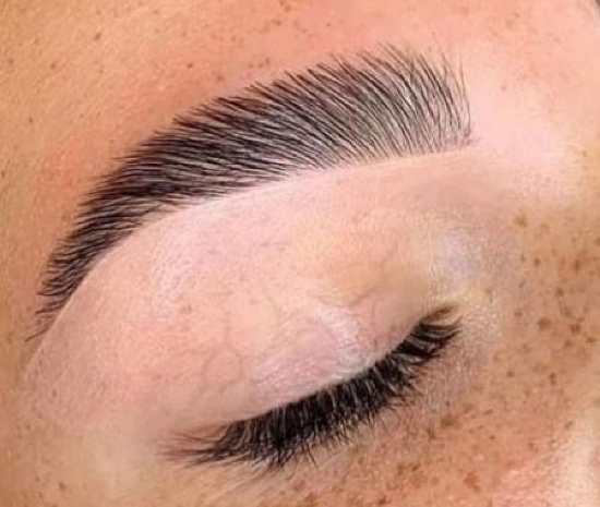 Qu'est-ce que le Brow Lift ?